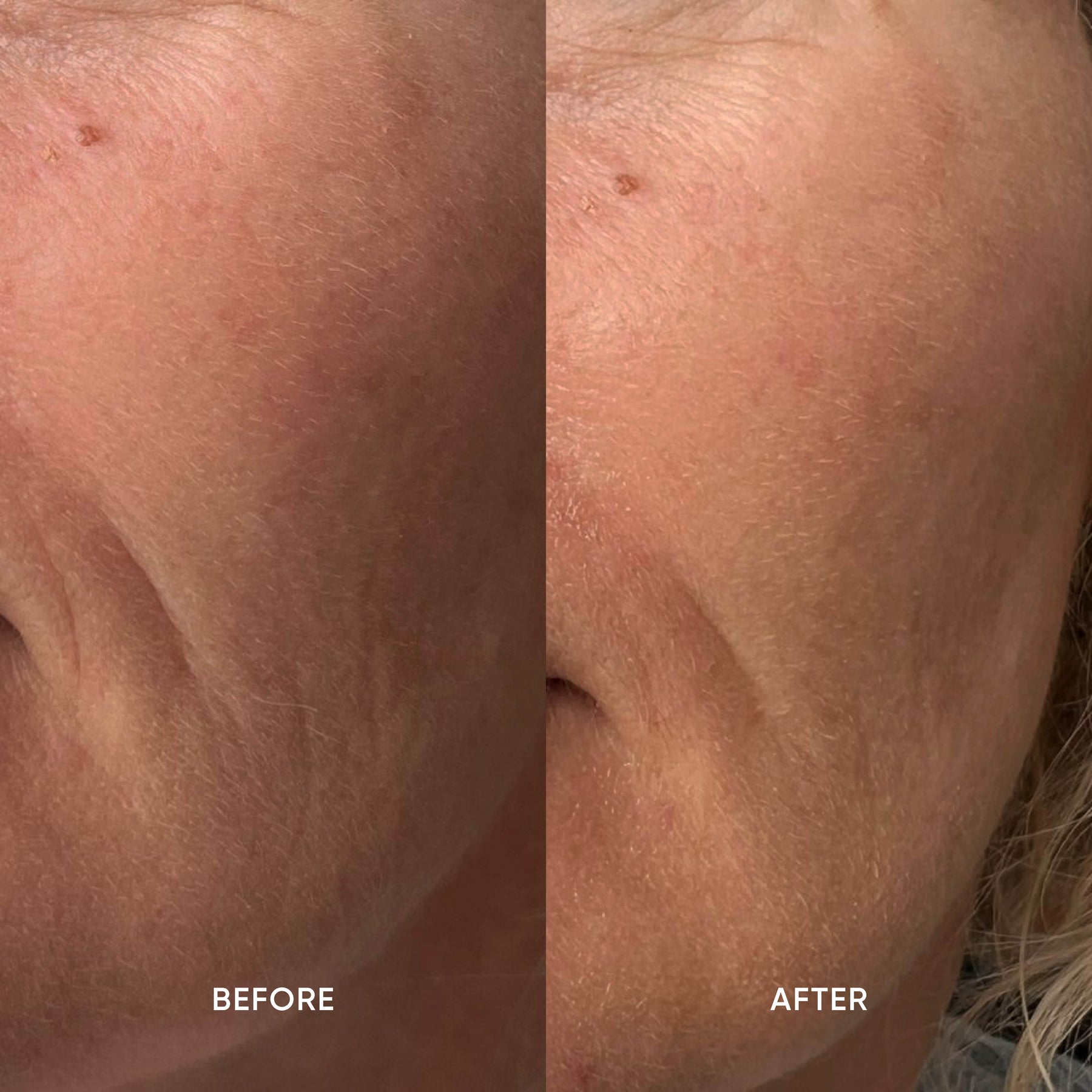ManukaRx Restorative Skin Oil before and after use customer images