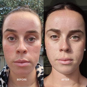 ManukaRx Vitamin C Gel Cleanser before and after use comparison images